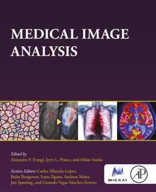 Imagen de portada: Medical Image Analysis 1st edition 9780128136577
