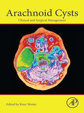 Cover image: Arachnoid Cysts 9780128143780