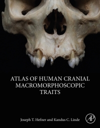 Omslagafbeelding: Atlas of Human Cranial Macromorphoscopic Traits 9780128143858
