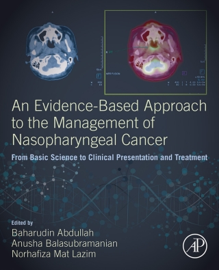Immagine di copertina: An Evidence-Based Approach to the Management of Nasopharyngeal Cancer 1st edition 9780128144039