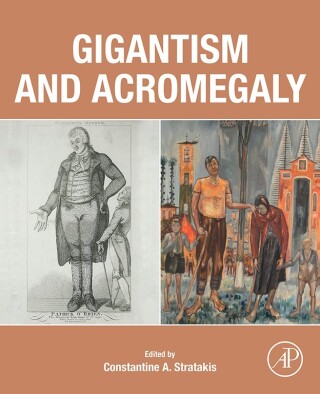 Cover image: Gigantism and Acromegaly 9780128145371
