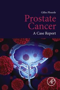 Omslagafbeelding: Prostate Cancer 9780128159668