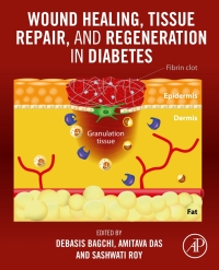 表紙画像: Wound Healing, Tissue Repair, and Regeneration in Diabetes 1st edition 9780128164136