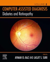 Omslagafbeelding: Diabetes and Retinopathy 1st edition 9780128174388