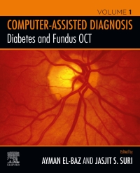 表紙画像: Diabetes and Fundus OCT 1st edition 9780128174401