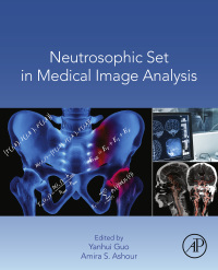 Titelbild: Neutrosophic Set in Medical Image Analysis 9780128181485