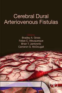 Cover image: Cerebral Dural Arteriovenous Fistulas 9780128195253