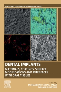 表紙画像: Dental Implants 9780128195864