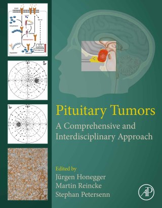 Cover image: Pituitary Tumors 9780128199497