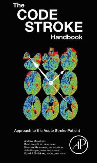 Cover image: The Code Stroke Handbook 9780128205228