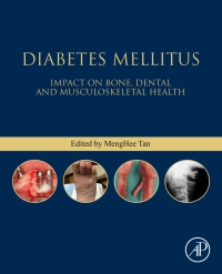 Omslagafbeelding: Diabetes Mellitus 1st edition 9780128206058