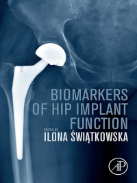 Imagen de portada: Biomarkers of Hip Implant Function 1st edition 9780128215968