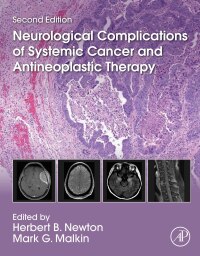 Cover image: Neurological Complications of Systemic Cancer and Antineoplastic Therapy 2nd edition 9780128219768