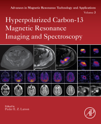 Cover image: Hyperpolarized Carbon-13 Magnetic Resonance Imaging and Spectroscopy 9780128222690