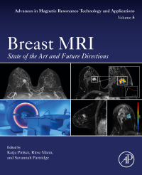 Cover image: Breast MRI 1st edition 9780128227299