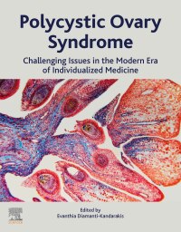 Cover image: Polycystic Ovary Syndrome 9780128230459