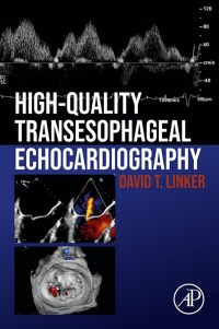 表紙画像: High-Quality Transesophageal Echocardiography 9780128229323