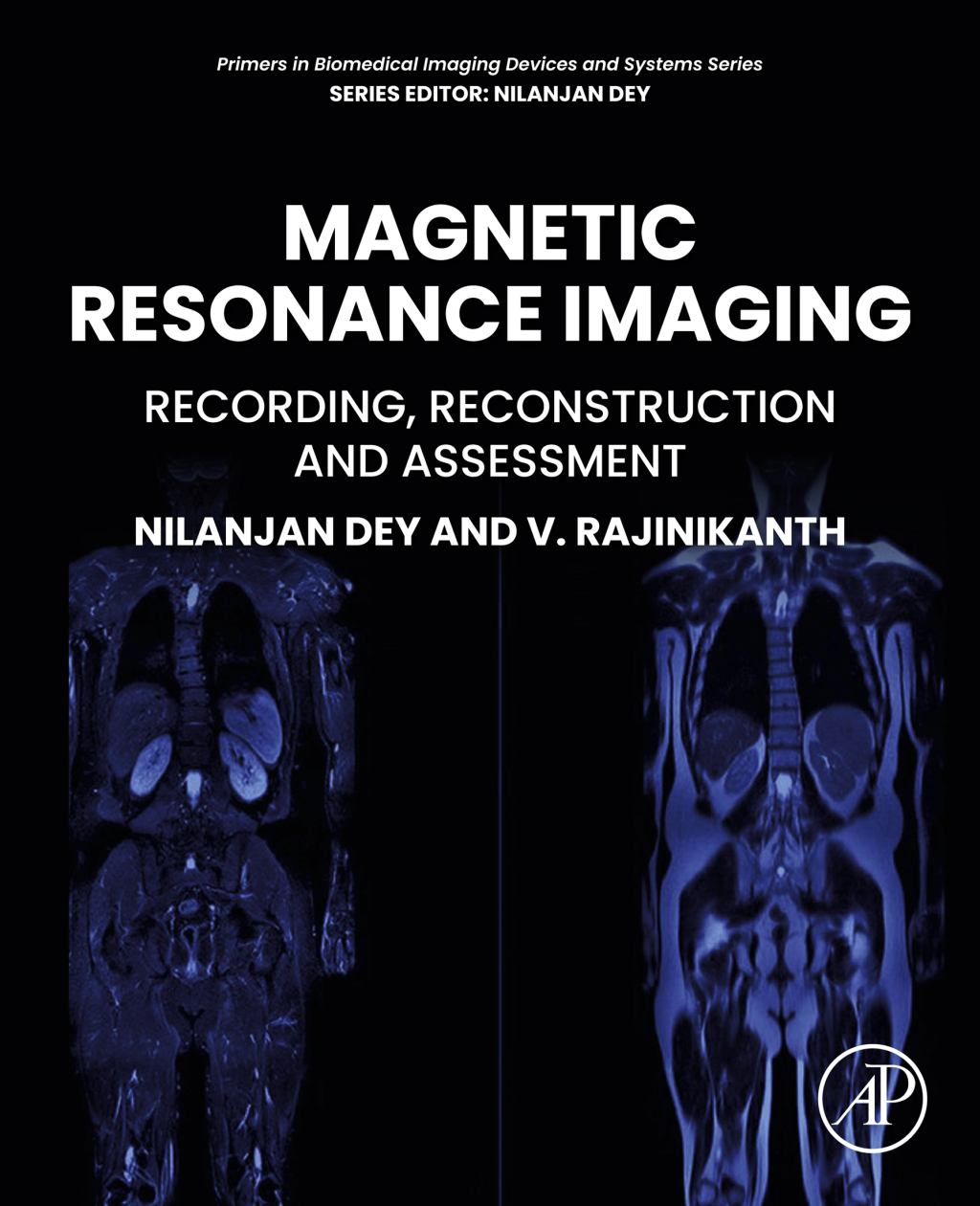 Magnetic Resonance Imaging Recording, Reconstruction and Assessment