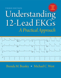 Cover image: Understanding 12-Lead EKGs 3rd edition 9780132921060