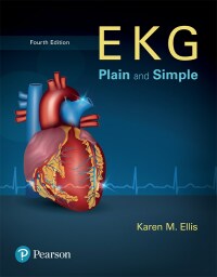 Cover image: EKG Plain and Simple 4th edition 9780134525051