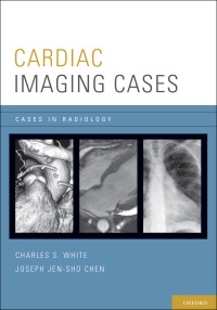 صورة الغلاف: Cardiac Imaging Cases 9780195395433