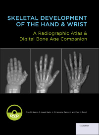 Cover image: Skeletal Development of the Hand and Wrist 9780199782055