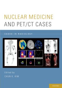 Omslagafbeelding: Nuclear Medicine and PET/CT Cases 1st edition 9780199773695