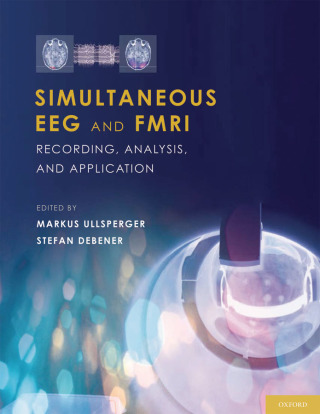 Immagine di copertina: Simultaneous EEG and fMRI 1st edition 9780195372731