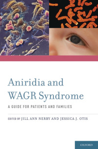 صورة الغلاف: Aniridia and WAGR Syndrome 1st edition 9780195389302