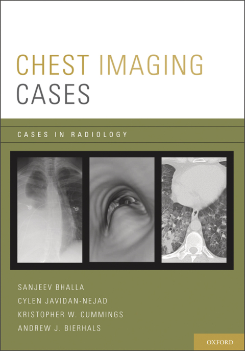 Chest Imaging Cases - FULL INSTANT DOWNLOAD | PDF DOCX EPUB