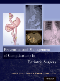 Cover image: Prevention and Management of Complications in Bariatric Surgery 1st edition 9780190608347