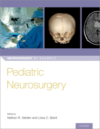 Cover image: Pediatric Neurosurgery 1st edition 9780190617073