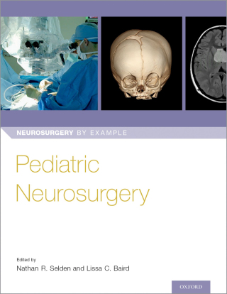 Imagen de portada: Pediatric Neurosurgery 1st edition 9780190617073