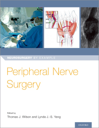 Omslagafbeelding: Peripheral Nerve Surgery 1st edition 9780190617127