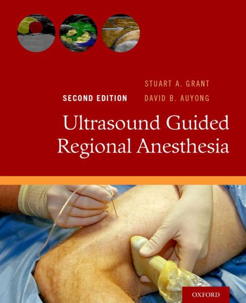 Ultrasound Guided Regional Anesthesia, 2nd Edition - FULL INSTANT DOWNLOAD | PDF DOCX EPUB