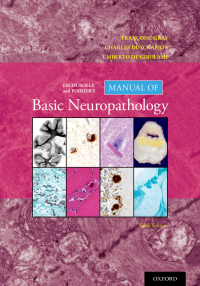 Imagen de portada: Escourolle and Poirier's Manual of Basic Neuropathology 6th edition 9780190675011