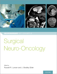 Cover image: Surgical Neuro-Oncology 1st edition 9780190696696