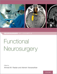 Imagen de portada: Functional Neurosurgery 1st edition 9780190887629