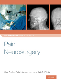 Cover image: Pain Neurosurgery 1st edition 9780190887674