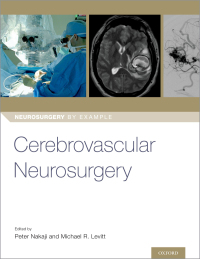 Cover image: Cerebrovascular Neurosurgery 1st edition 9780190887728