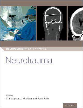 Cover image: Neurotrauma 1st edition 9780190936259