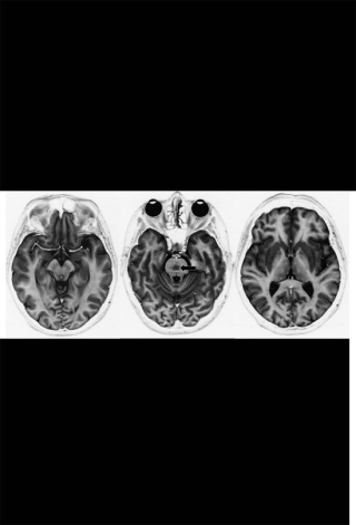 Cover image: Neurological Case Histories 9780192631626
