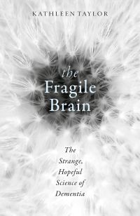 Cover image: The Fragile Brain 9780198726081
