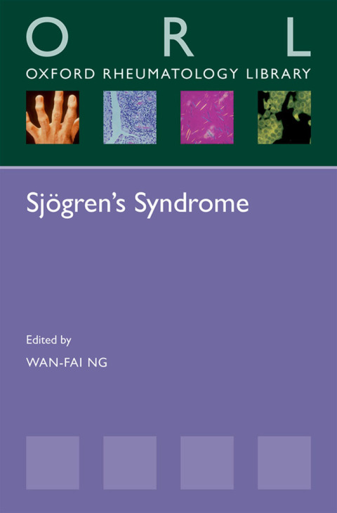 Sjögren's Syndrome, 1st Edition - FULL INSTANT DOWNLOAD | PDF DOCX EPUB