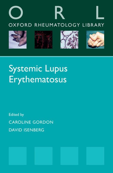 Systemic Lupus Erythematosus, 1st Edition - FULL INSTANT DOWNLOAD | PDF DOCX EPUB