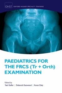 Imagen de portada: Paediatrics for the FRCS (Tr   Orth) Examination 1st edition 9780198749301