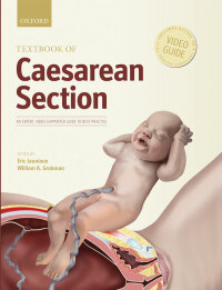 Imagen de portada: Textbook of Caesarean Section 9780198758563