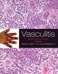 Imagen de portada: Vasculitis 2nd edition