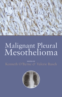 Cover image: Malignant Pleural Mesothelioma 1st edition 9780198529309