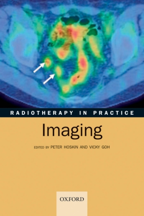 Radiotherapy in Practice - Imaging, 1st Edition - FULL INSTANT DOWNLOAD | PDF DOCX EPUB